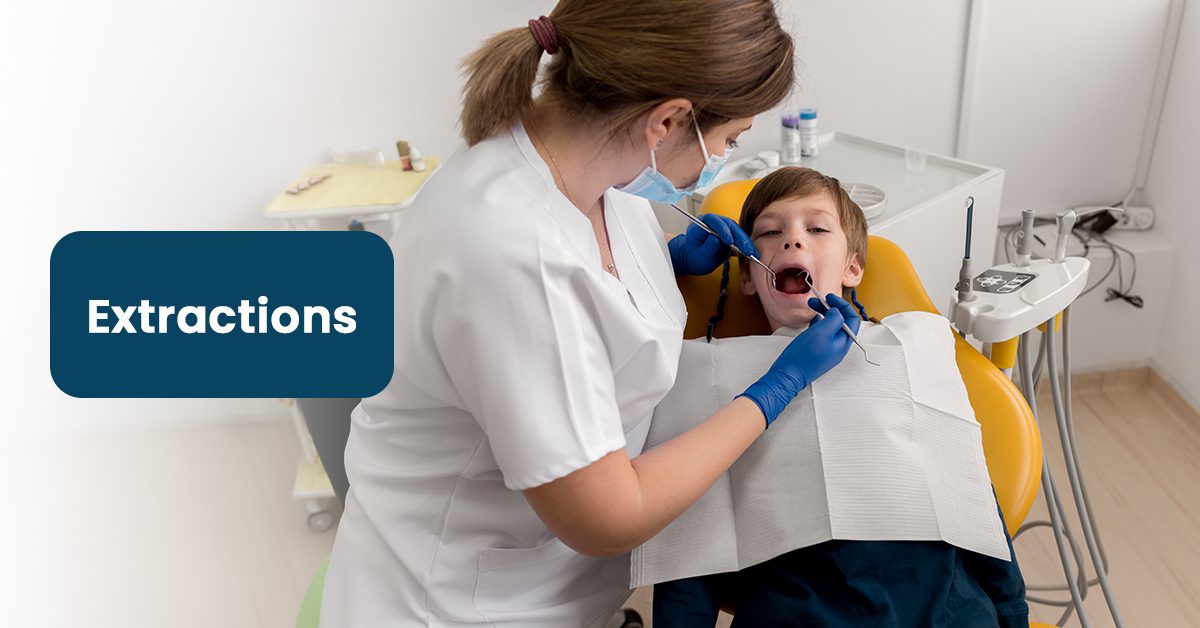 Pediatric Extraction Code Pediatric Tooth Extractions Annapolis | One Tooth Pediatric Dental